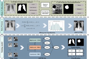 Multi-Task Hierarchical Model of Medical Images Based on Alternate Interaction